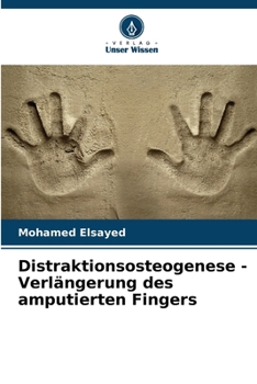 Paperback Distraktionsosteogenese - Verlängerung des amputierten Fingers [German] Book