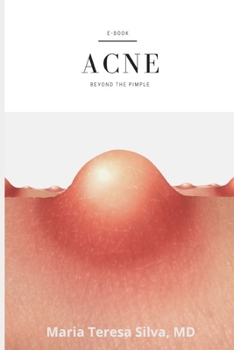 Paperback Acne: beyond a pimple Book