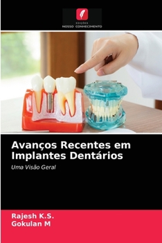 Paperback Avanços Recentes em Implantes Dentários [Portuguese] Book