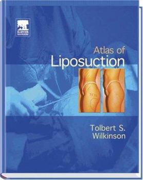 Hardcover Atlas of Liposuction Book