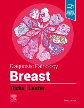 Hardcover Diagnostic Pathology: Breast Book