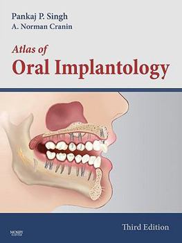 Hardcover Atlas of Oral Implantology Book