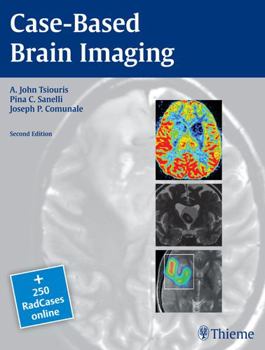 Paperback Case-Based Brain Imaging Book