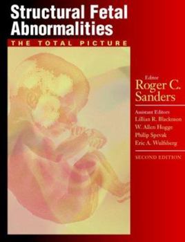 Paperback Structural Fetal Abnormalities: The Total Picture Book