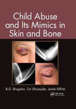 Hardcover Child Abuse and its Mimics in Skin and Bone Book