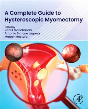 Paperback A Complete Guide to Hysteroscopic Myomectomy Book