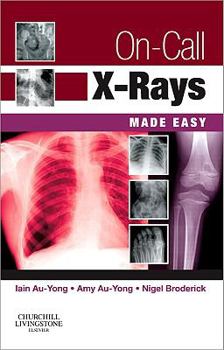 Paperback On-Call X-Rays Made Easy Book