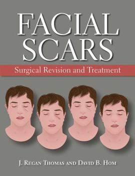 Hardcover Facial Scars: Surgical Revision and Treatment Book
