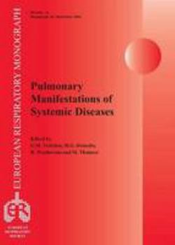 Paperback Pulmonary Manifestations of Systemic Diseases (European Respiratory Monograph) Book