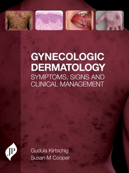 Gynecologic Dermatology: Symptoms, Signs and Clinical Management