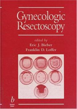 Hardcover Gynecologic Resectoscopy (Minimally Invasive Gynecology) Book