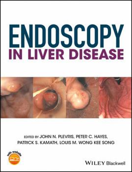 Hardcover Endoscopy in Liver Disease Book