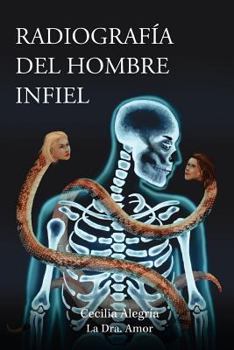 Paperback Radiografia del Hombre Infiel: Cómo detectarlo para no caer en su trampa... O cómo salirse de su trampa... ¡a tiempo! [Spanish] Book