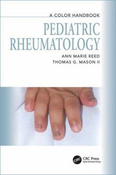 Paperback Pediatric Rheumatology: A Color Handbook Book