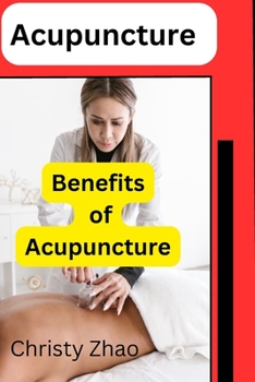 Paperback Acupuncture: Benefits of Acupuncture Book