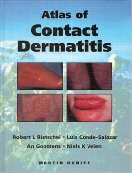 Hardcover An Atlas of Contact Dermatitis Book