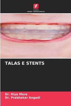 Talas E Stents (Portuguese Edition)