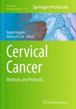 Paperback Cervical Cancer: Methods and Protocols Book