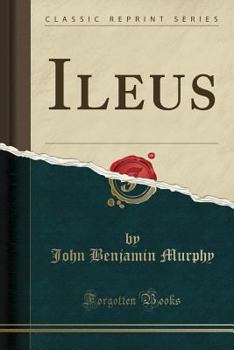 Paperback Ileus (Classic Reprint) Book