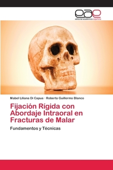 Paperback Fijación Rígida con Abordaje Intraoral en Fracturas de Malar [Spanish] Book