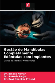 Gestão de Mandíbulas Completamente Edêntulas com Implantes: Gestão de Edêntulos Mandibulares