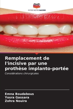 Paperback Remplacement de l'incisive par une prothèse implanto-portée [French] Book