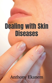 Paperback Dealing with Skin Diseases Book