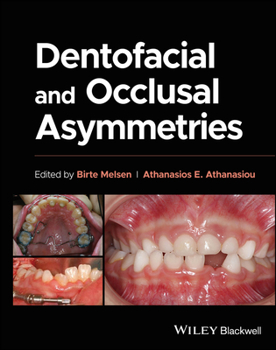 Hardcover Dentofacial and Occlusal Asymmetries Book