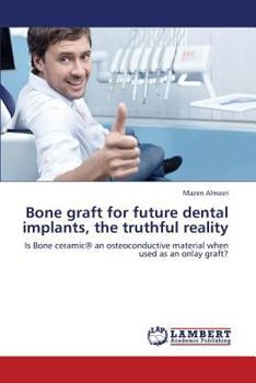 Paperback Bone Graft for Future Dental Implants, the Truthful Reality Book