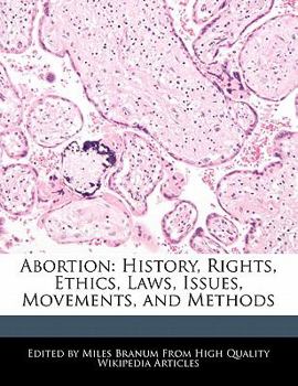 Paperback Abortion: History, Rights, Ethics, Laws, Issues, Movements, and Methods Book