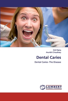 Paperback Dental Caries Book