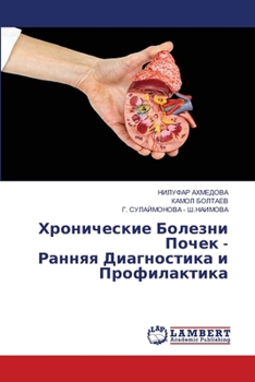 Paperback Хронические Болезни Поч& [Russian] Book