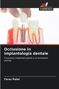 Paperback Occlusione in implantologia dentale [Italian] Book