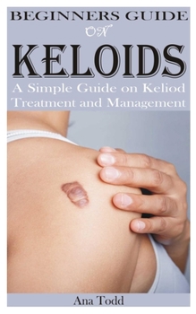 Paperback Beginners Guide on Keloids Book