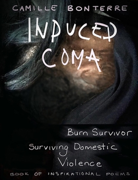 Paperback Induced Coma: Burn Survivor, Surviving Domestic Violence: Book of Inspirational Poems and Drawings Book