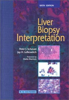 Hardcover Liver Biopsy Interpretation Book