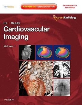 Hardcover Cardiovascular Imaging, 2-Volume Set: Expert Radiology Series Book