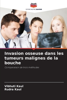 Paperback Invasion osseuse dans les tumeurs malignes de la bouche [French] Book