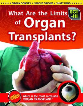 Hardcover What Are the Limits of Organ Transplants? Book