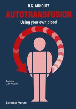 Paperback Autotransfusion: Using Your Own Blood Book