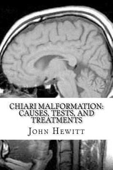 Paperback Chiari Malformation: Causes, Tests, and Treatments Book