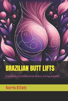 Paperback Brazilian Butt Lifts: Everything You Should Know Before, During and After Book