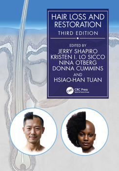 Hardcover Hair Loss and Restoration Book