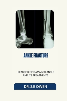 Paperback Ankle Fracture: Reasons of Damaged Ankle and Its Treatments Book