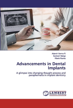 Paperback Advancements in Dental Implants Book