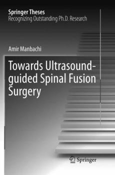 Paperback Towards Ultrasound-Guided Spinal Fusion Surgery Book