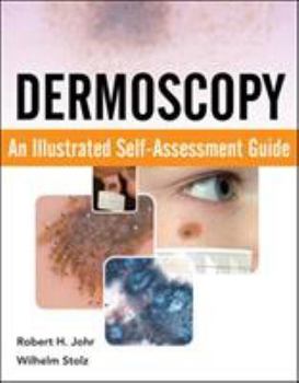 Paperback Dermoscopy: An Illustrated Self-Assessment Guide Book