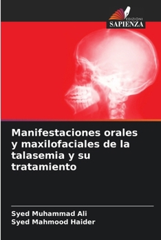 Manifestaciones orales y maxilofaciales de la talasemia y su tratamiento (Italian Edition)