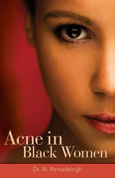 Paperback Acne in Black Women Book