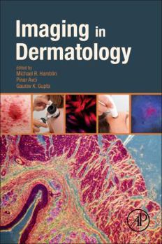Paperback Imaging in Dermatology Book